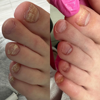 Виктория Парубоча, Катовице Фото - 5