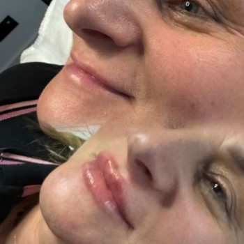 Nataly Ivanchenko, Katowice Фото - 5