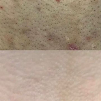 Svetlana , Katowice Фото - 5