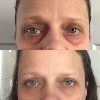 Magdalena Szczepka, Katowice Фото - 5