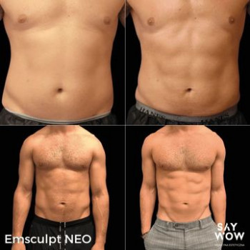 SayWOW!, Katowice Фото - 7