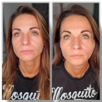 Renata Starowicz, Katowice Фото - 5