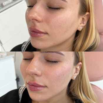 Sandra Kruz, Katowice Фото - 5