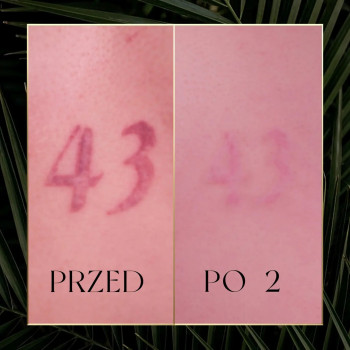 Laser Spot, Katowice Фото - 5