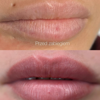 Паулина Копиец, Катовице Фото - 6