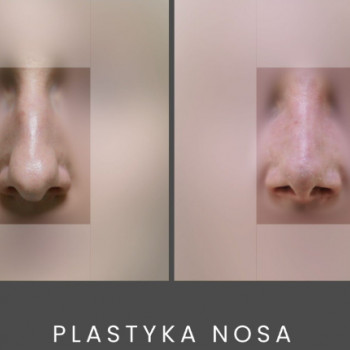 Mazan, Katowice Фото - 5