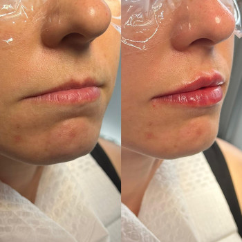 Skórna, Катовице Фото - 5