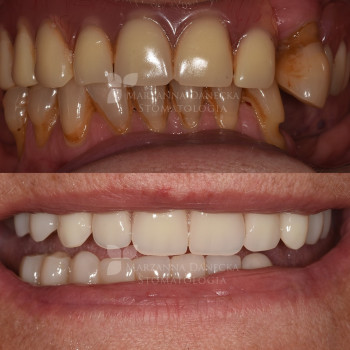 Marzanna Danecka, Katowice Фото - 5