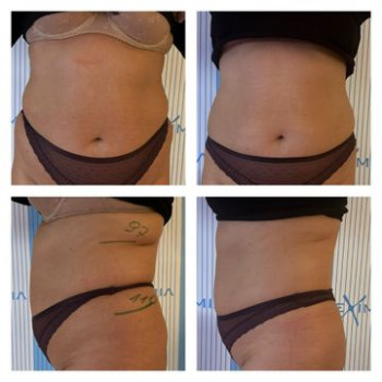 Fizjo & Beauty, Bialystok Фото - 5