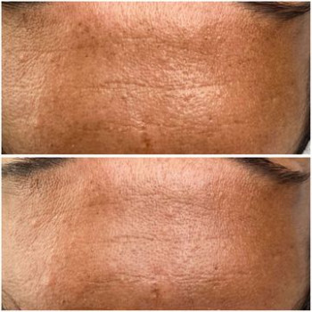 EweLu, Белосток Фото - 5