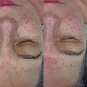 Cold Look, Bialystok Фото - 5