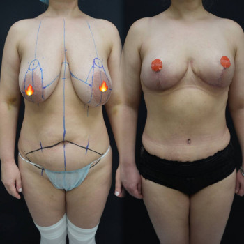 Эталон, Moscow Фото - 16