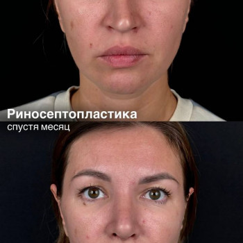 Эталон, Moscow Фото - 23