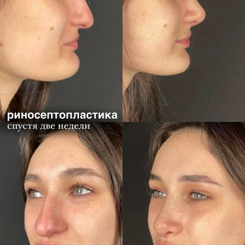 Эталон, Moscow Фото - 27