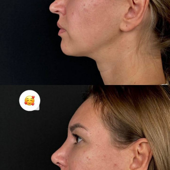 Эталон, Moscow Фото - 31