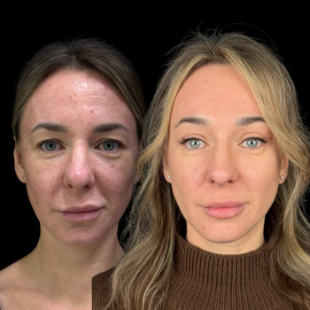 Эталон, Moscow Фото - 33