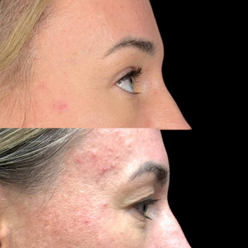 Эталон, Moscow Фото - 36