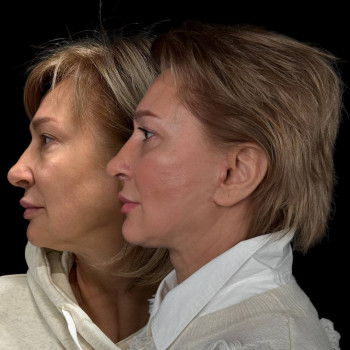 Эталон, Moscow Фото - 37