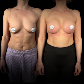 Эталон, Moscow Фото - 39