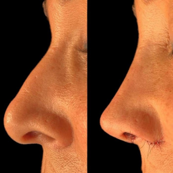 Эталон, Moscow Фото - 51