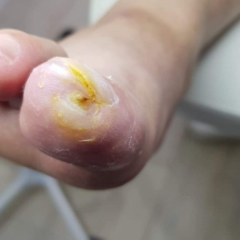 Наталья Гончарова, Haifa Фото - 5