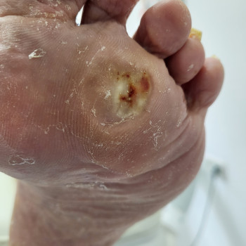 Наталья Гончарова, Haifa Фото - 9