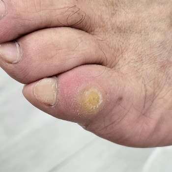 Наталья Гончарова, Haifa Фото - 12