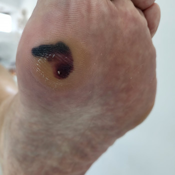 Наталья Гончарова, Haifa Фото - 16