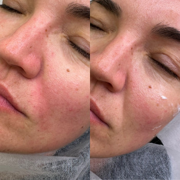 Анна Приходько, Варшава Фото - 11