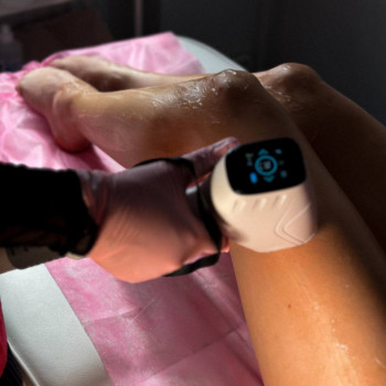 Róża Laser, Щецин Фото - 5