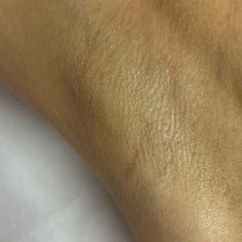 Róża Laser, Щецин Фото - 7