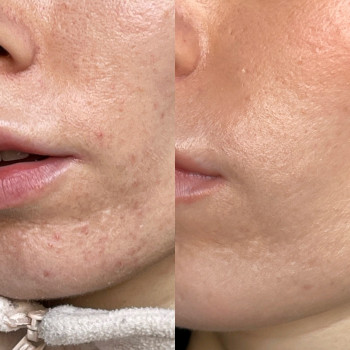 Jane Mogilevskaya, Petah Tikva Фото - 6