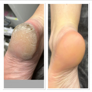 Svetlana , Петах-Тиква Фото - 5