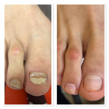 Svetlana , Петах-Тиква Фото - 7