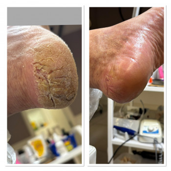 Svetlana , Петах-Тиква Фото - 8