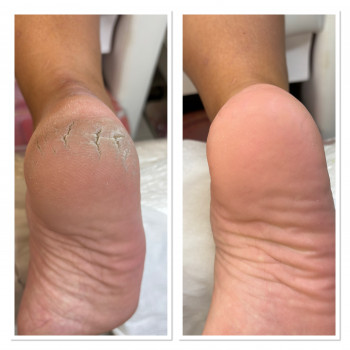 Svetlana , Петах-Тиква Фото - 10