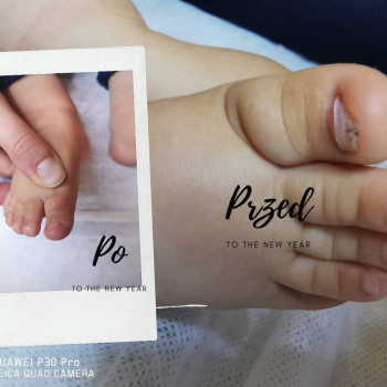 Wrastające paznokcie u niemowlaka? To dla nas żaden problem! Oferujemy bezpieczne i skuteczne rozwiązania dopasowane do malutkich stópek. Delikatne podejście i troska o komfort małego pacjenta to nasz priorytet.