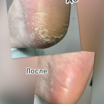 Maryna Tsybulko, Гамбург Фото - 10