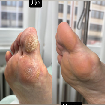 Maryna Tsybulko, Гамбург Фото - 32