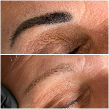 Usuwanie PMU i Tatuazu ansty beauty