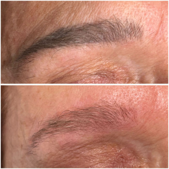 Usuwanie PMU i Tatuazu ansty beauty