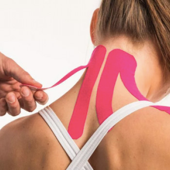 Кинезиотейпирование