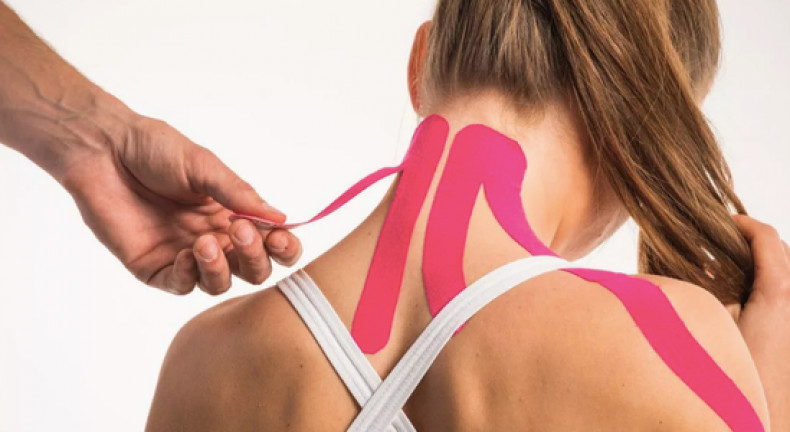 Кинезиотейпирование