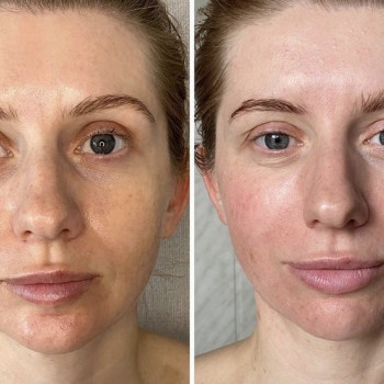 Курс массажа лица