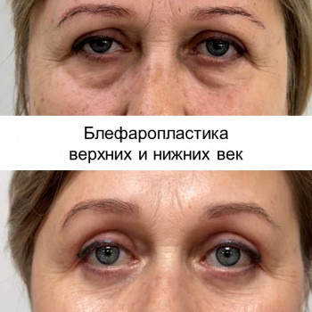 Максим Леонидович Нестеренко, Moscow Фото - 11