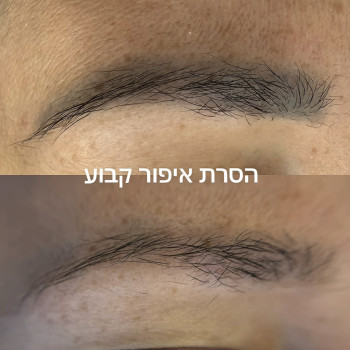 הסרת איפור קבוע