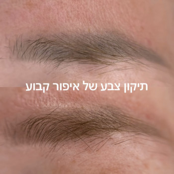 תיקון צבע של איפור קבוע בלייזר