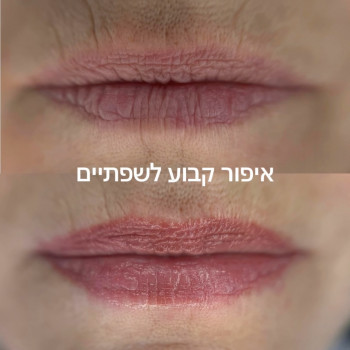 איפור קבוע לשפתיים