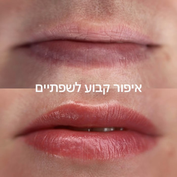איפור קבוע לשפתיים