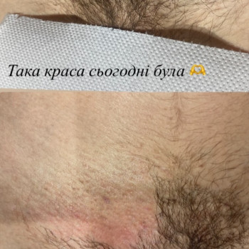 Массаж лица от морщин